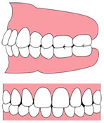 歯並び